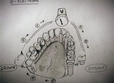 blog-25
