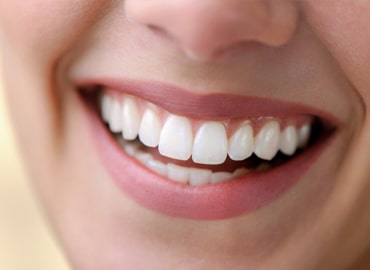 smile-design